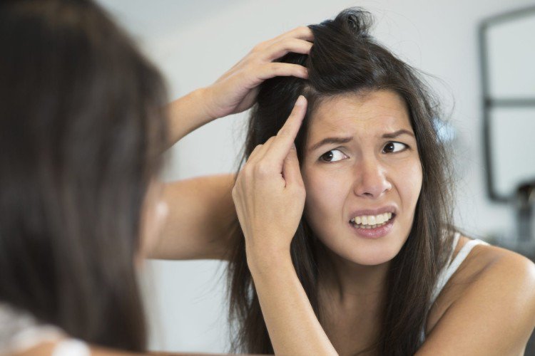 Remédios caseiros para lista de caspa - tratamento de cabelo em casa
