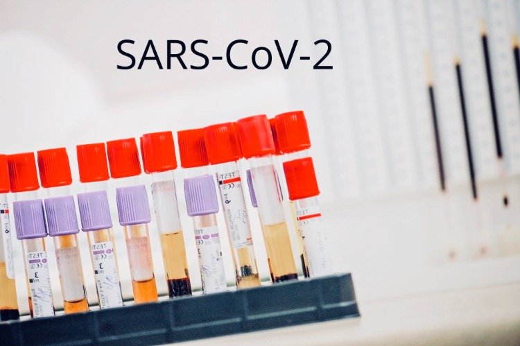 analisando amostras de sangue de anticorpos sars cov 2 durante a pandemia