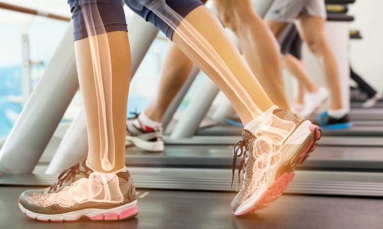 Pernas com ossos mostrados como raio-x em treinamento em esteira na academia