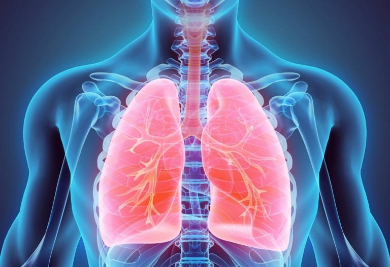 Remédios caseiros para tosse para bronquite com catarro e expectoração