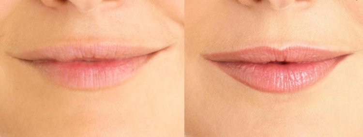 contorno-maquiagem-permanente-lábios-antes-depois-das-fotos
