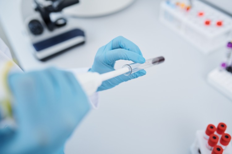 teste de sangue em laboratório para anticorpos contra sars-cov-2